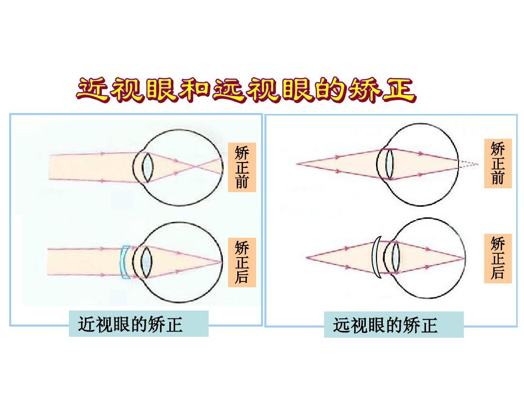 前視后視怎么區(qū)分-圖1