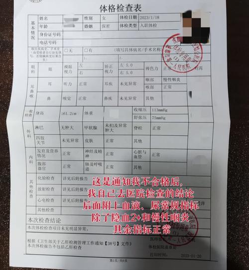 事業單位體檢什么情況下會不過(入職體檢嚴不嚴)-圖1