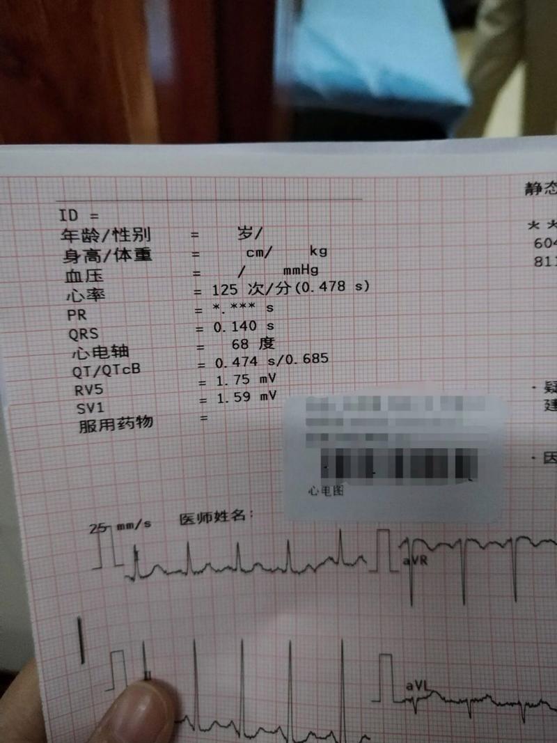 教資體檢心率過快能過嗎-圖1